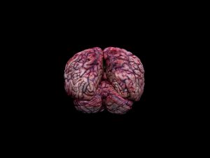 Human Brain - Man 46